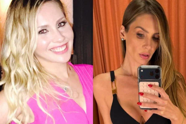 Ex-BBB Ana Carolina Madeira surpreende ao mostrar antes e depois; veja foto