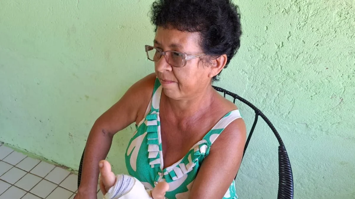 Sogra que teve dedo decepado pelo genro: "Ele disse que eu não devia viver"