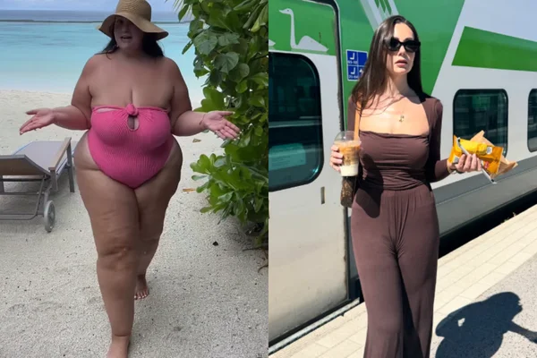 Influenciadora de positividade corporal faz cirurgias e perde mais de 79 kg